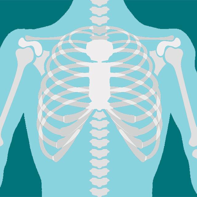chest and arm x-ray illustration